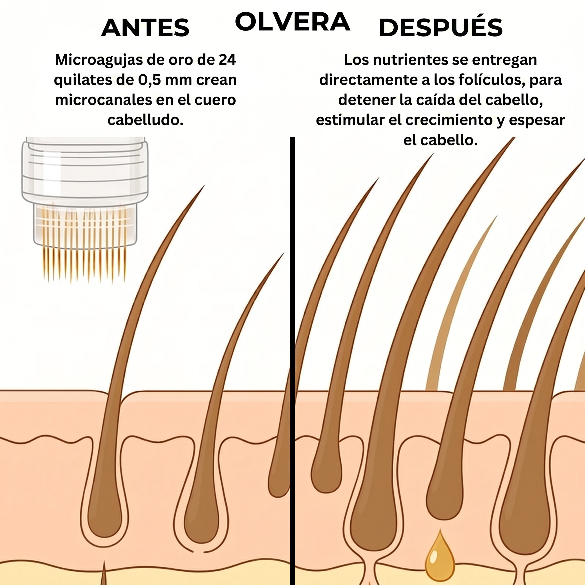 Tecnología Capilar Micro-infuse® para Hombre